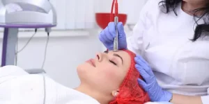 Kurs za dijamantsku mikrodermoabraziju